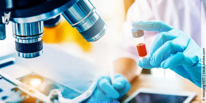 Blutspenden mit Hashimoto: Warum dein Beitrag wertvoll ist und was du für eine sichere Spende wissen musst