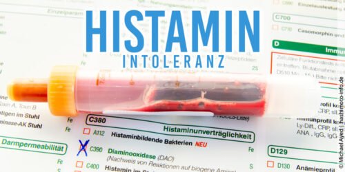 Histaminintoleranz und Hashimoto: Einblicke in die Wechselwirkungen von Histamin mit der Schilddrüsenfunktion
