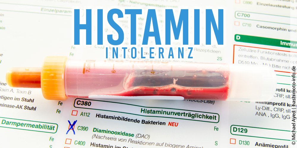 Hashimoto & Histaminintoleranz: Einblicke in die Wechselwirkungen von Histamin mit der Schilddrüsenfunktion