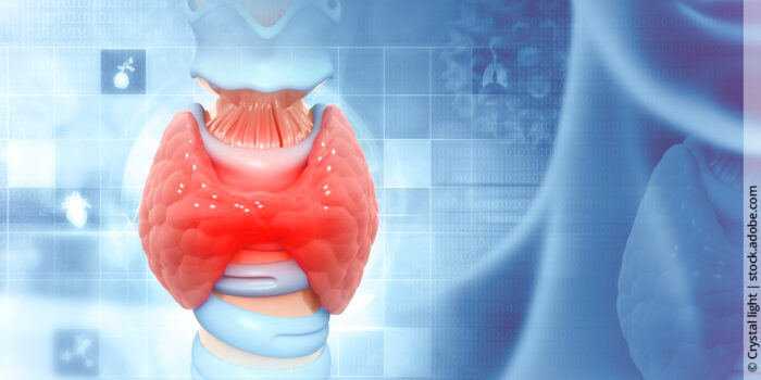 Schilddrüsenunterfunktion oder Hashimoto-Thyreoiditis? Die richtige Untersuchung macht den Unterschied