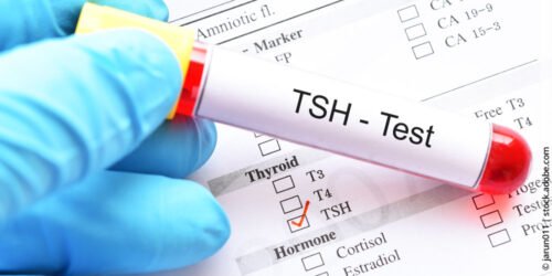 Die Bedeutung des TSH-Wertes bei Schilddrüsendiagnostik: Goldstandard oder überbewertet?